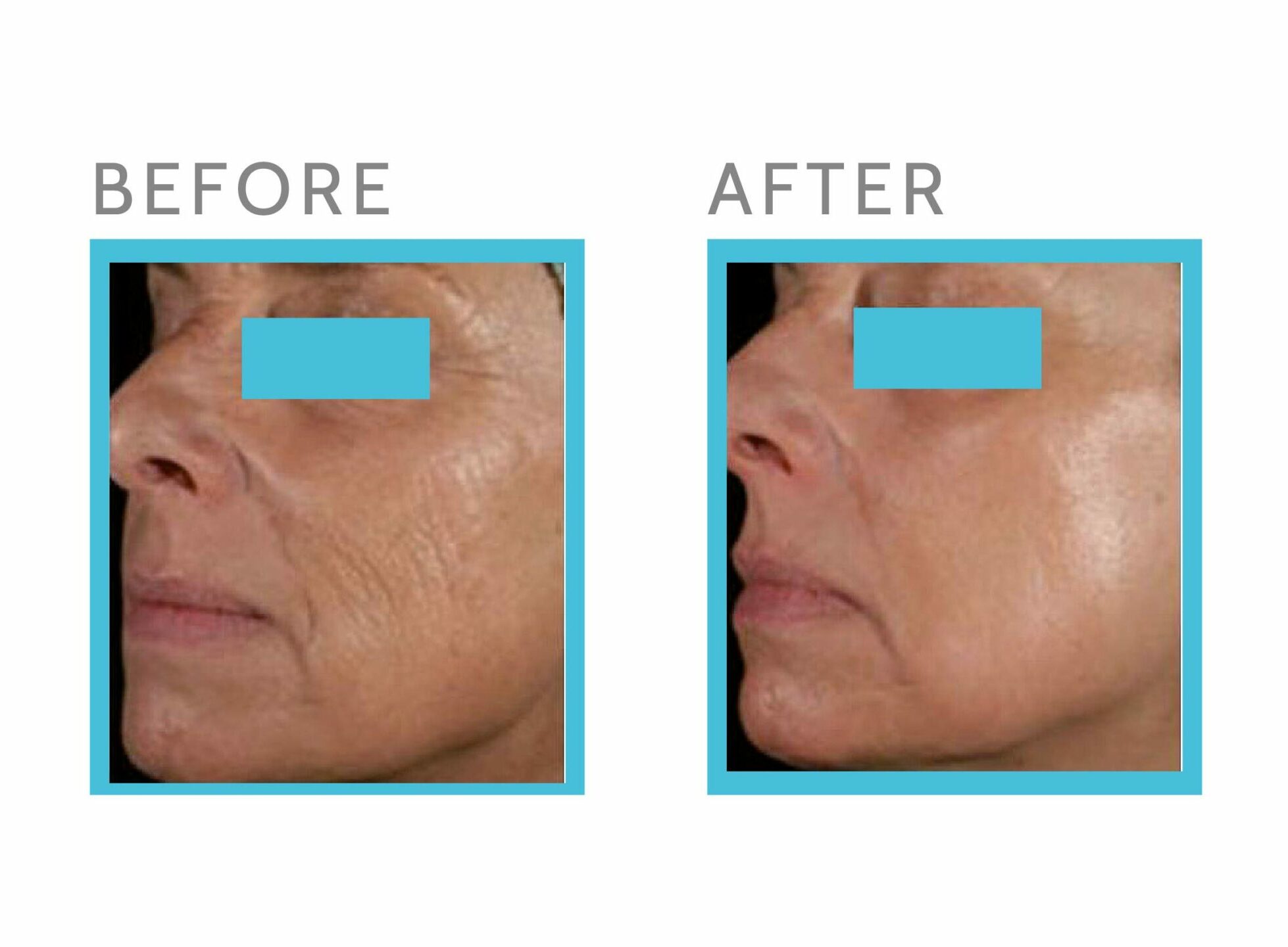 Before After E Pharma Middle East